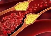 研究发现纳米机器人可清除血栓