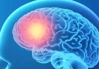 大规模临床试验证实：低风险卒中患者监测频率可减半至17次