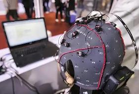 广东脑机接口“指导价”：置入费最高6600元，取出费最高3200元